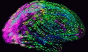 Brain image, UCLA LONI